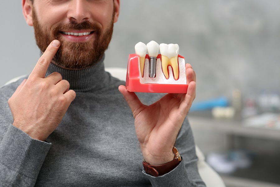 Are Dental Implants Really the Best Solution?